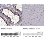 Anti-PABPC1 Antibody