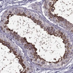 Immunohistochemical staining of human testis shows strong cytoplasmic positivity in cells in seminiferous ducts.