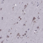 Immunohistochemical staining of human cerebral cortex shows moderate cytoplasmic positivity in neuronal cells.