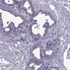 Anti-PABPC1 Antibody