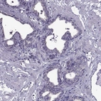 Immunohistochemical staining of human prostate shows no cytoplasmic positivity in glandular cells as expected.