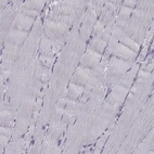 Immunohistochemical staining of human skeletal muscle shows no cytoplasmic positivity in myocytes as expected.