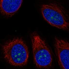 Anti-TMEM217 Antibody