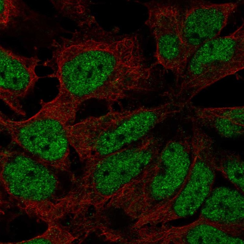 Anti-ZNF560 Antibody