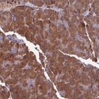 Anti-COMMD10 Antibody