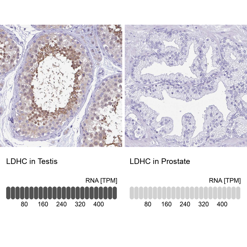 Anti-LDHC Antibody