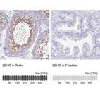 Anti-LDHC Antibody