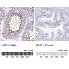 Anti-LDHC Antibody
