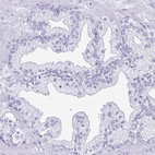 Immunohistochemical staining of human prostate shows low expression as expected.