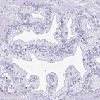Immunohistochemical staining of human prostate shows low expression as expected.