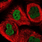 Immunofluorescent staining of human cell line A-431 shows localization to nucleoplasm.