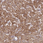 Immunohistochemical staining of human liver shows strong granular cytoplasmic positivity in hepatocytes.