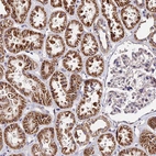 Immunohistochemical staining of human kidney shows strong granular cytoplasmic positivity in cells in tubules.