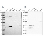 Western blot analysis using Anti-EIF3K antibody HPA045446 (A) shows similar pattern to independent antibody HPA054590 (B).