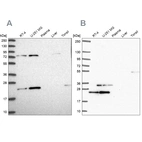 Western blot analysis using Anti-EIF3K antibody HPA045446 (A) shows similar pattern to independent antibody HPA054590 (B).