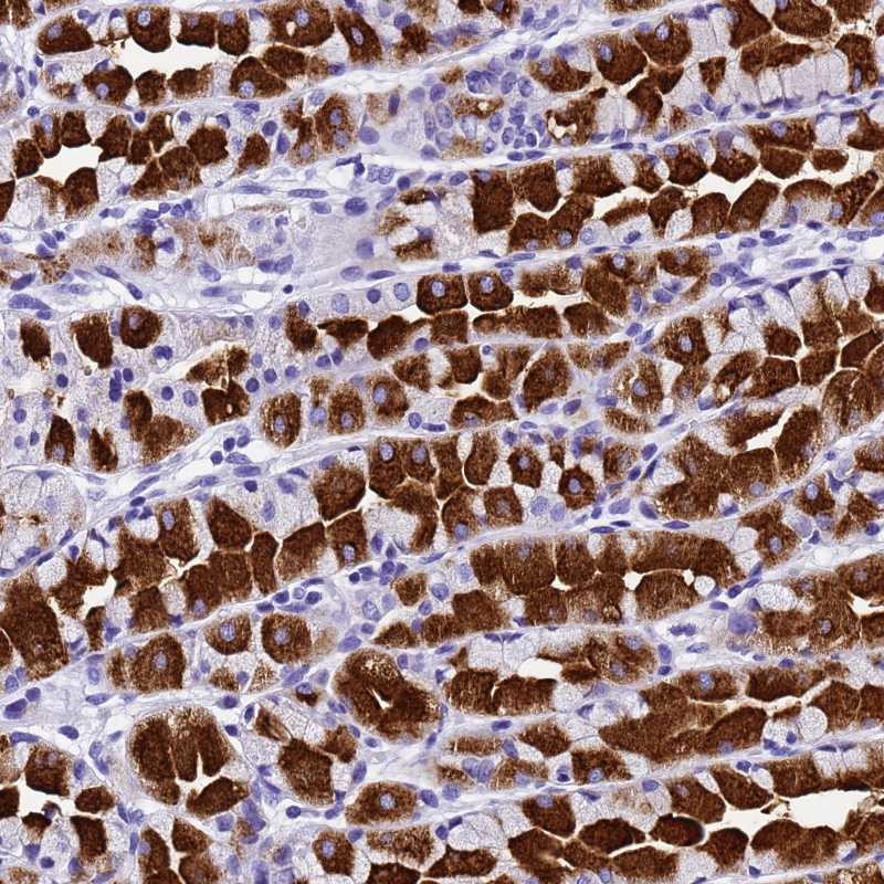 Anti-HERC4 Antibody