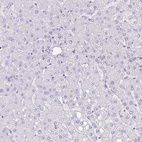 Immunohistochemical staining of human liver shows no positivity in hepatocytes as expected.