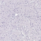 Immunohistochemical staining of human liver shows no positivity in hepatocytes as expected.