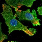 Immunofluorescent staining of human cell line PC-3 shows localization to plasma membrane & cytosol.