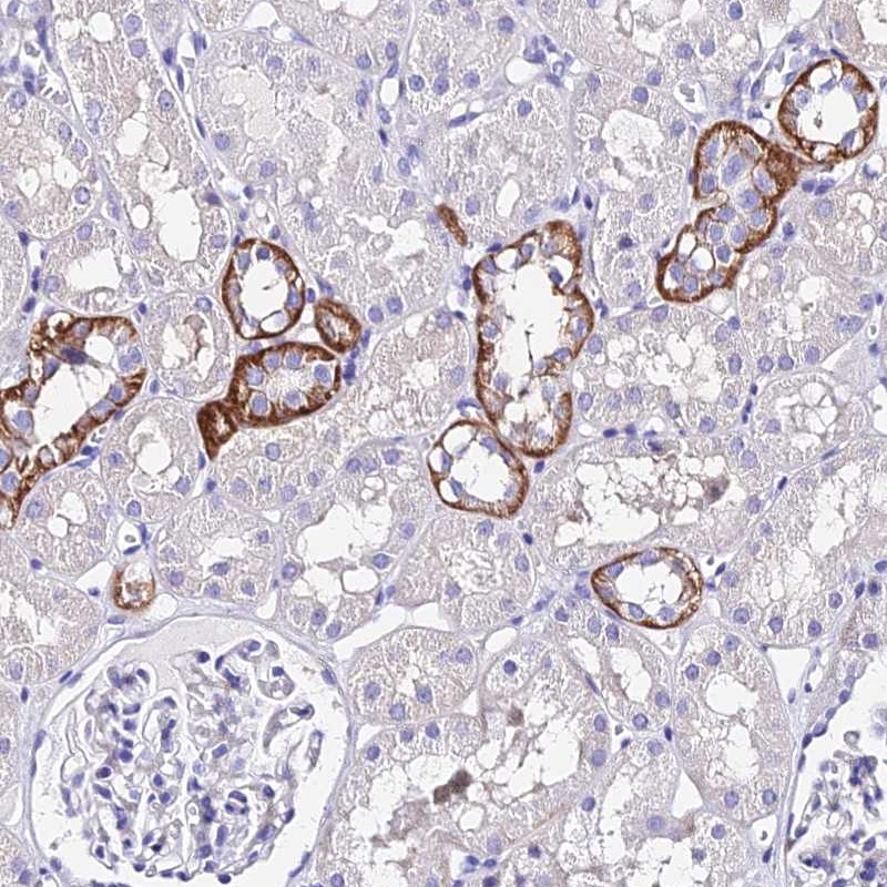 Anti-TRMT44 Antibody