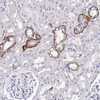 Anti-TRMT44 Antibody