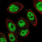 Immunofluorescent staining of human cell line PC-3 shows localization to nucleoplasm.