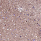 Anti-HECTD4 Antibody