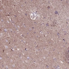 Anti-HECTD4 Antibody