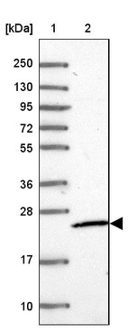 Lane 1: Marker [kDa] 250, 130, 95, 72, 55, 36, 28, 17, 10_br/_Lane 2: Human cell line RT-4