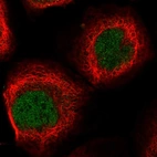 Immunofluorescent staining of human cell line A-431 shows localization to nucleoplasm.
