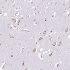 Immunohistochemical staining of human cerebral cortex shows strong cytoplasm granular positivity in neurons.