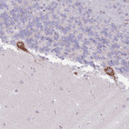 Immunohistochemical staining of human cerebellum shows strong cytoplasm granular positivity in Purkinje cells.