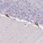 Immunohistochemical staining of human cerebellum shows strong cytoplasm granular positivity in Purkinje cells.