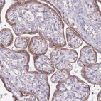 Immunohistochemical staining of human placenta shows strong cytoplasm granular positivity in in trophoblastic cells.