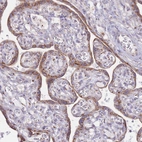 Immunohistochemical staining of human placenta shows strong cytoplasm granular positivity in in trophoblastic cells.
