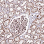 Anti-SIPA1L3 Antibody