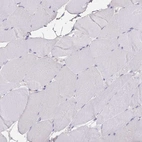Immunohistochemical staining of human skeletal muscle shows low expression as expected.