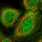 Immunofluorescent staining of human cell line A-431 shows localization to nucleoplasm, plasma membrane & cytosol.