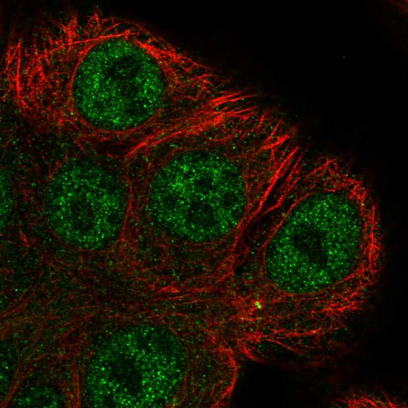 Anti-ARHGEF38 Antibody