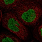 Immunofluorescent staining of human cell line A-431 shows localization to nucleoplasm & nuclear membrane.