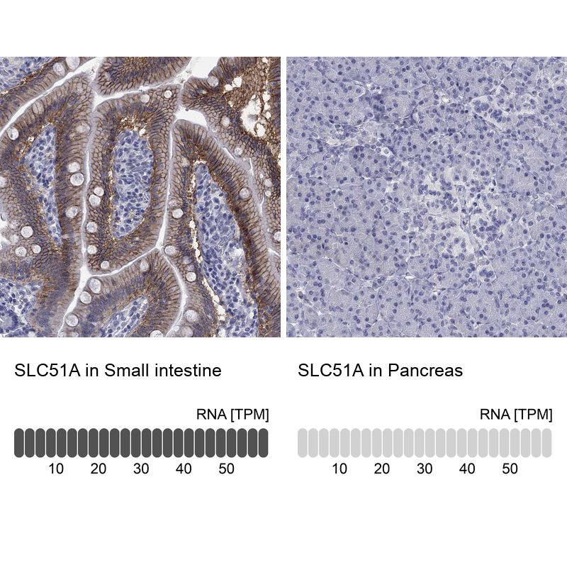 Anti-SLC51A Antibody