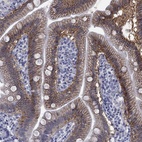 Anti-SLC51A Antibody