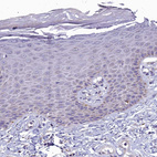 Immunohistochemical staining of human skin shows no positivity in squamous epithelial cells as expected.