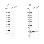 Western blot analysis using Anti-COX20 antibody HPA045490 (A) shows similar pattern to independent antibody HPA043617 (B).