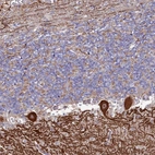 Anti-KCTD18 Antibody