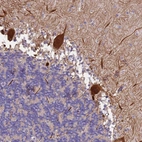 Anti-SLC24A3 Antibody
