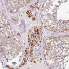 Anti-NF1 Antibody