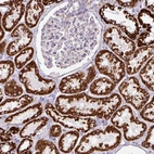 Immunohistochemical staining of human kidney shows strong granular cytoplasmic positivity in cells in tubules.