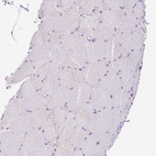 Immunohistochemical staining of human skeletal muscle shows no positivity in myocytes as expected.