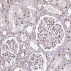 Anti-KPNA4 Antibody